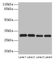 PMM1 Antibody (PACO29022)