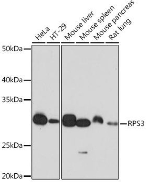 Anti-RPS3 Antibody (CAB4872)