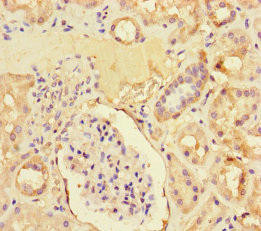ZNF366 Antibody (PACO31276)