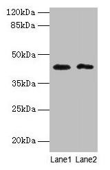 BTBD2 Antibody (PACO31904)