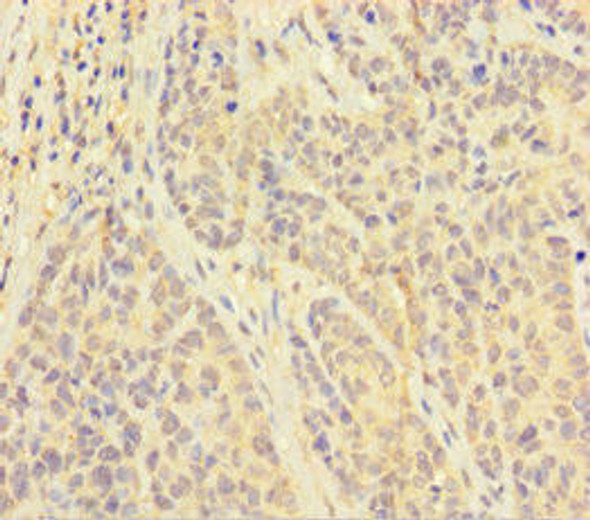 PAPPA Antibody (PACO32280)