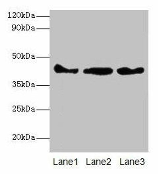 Actb Antibody (PACO32444)
