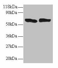 TNF Antibody (PACO32616)