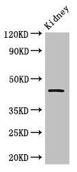 Tp53 Antibody (PACO33608)