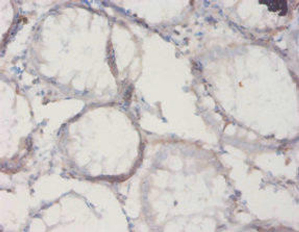Il18bp Antibody (PACO33744)