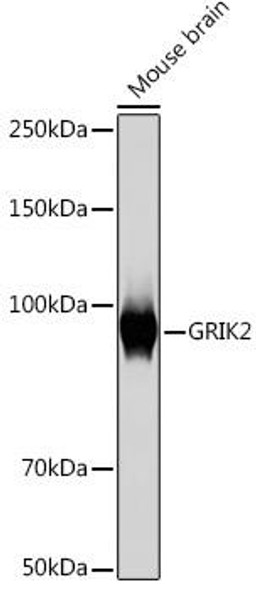Anti-GRIK2 Antibody (CAB9722)