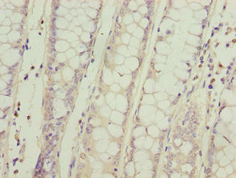 SPCS2 Antibody (PACO35458)