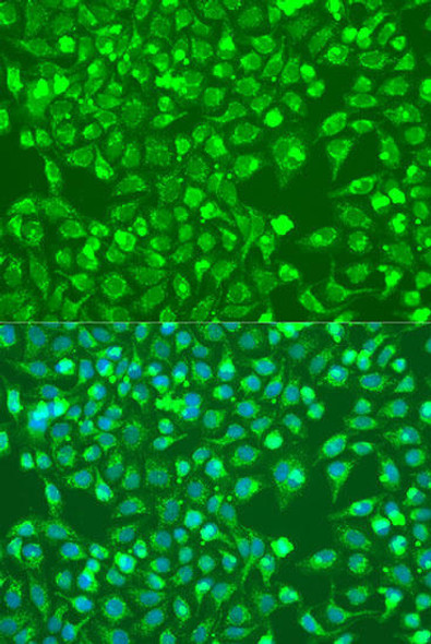 Anti-BMP6 Antibody (CAB15648)