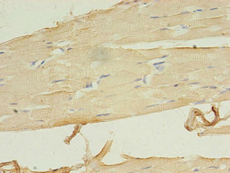 LRRN1 Antibody (PACO36854)