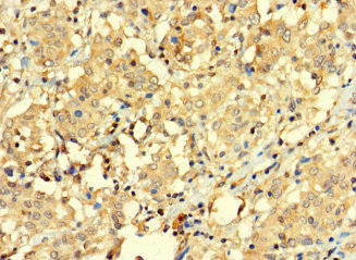 BAGE3 Antibody (PACO37254)