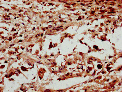 NSMCE2 Antibody (PACO38498)