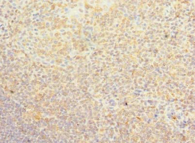 PSD4 Antibody (PACO39138)