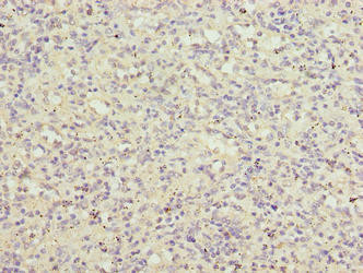 LRRC3B Antibody (PACO40194)