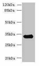 CCDC106 Antibody (PACO40498)