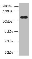 GDPD2 Antibody (PACO40614)