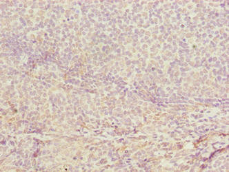 CDADC1 Antibody (PACO41266)