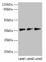 LDAH Antibody (PACO41342)