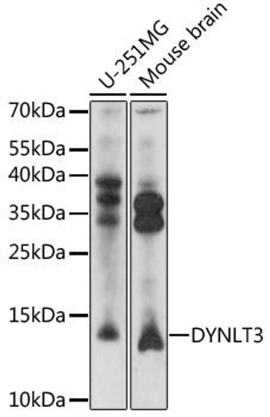 Anti-DYNLT3 Antibody (CAB16982)