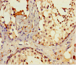 IFT80 Antibody (PACO42022)