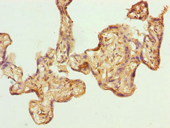 GPSM3 Antibody (PACO42626)
