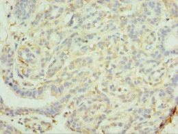 MAGEC2 Antibody (PACO43871)