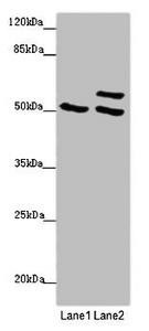 TUBB4A Antibody (PACO46306)