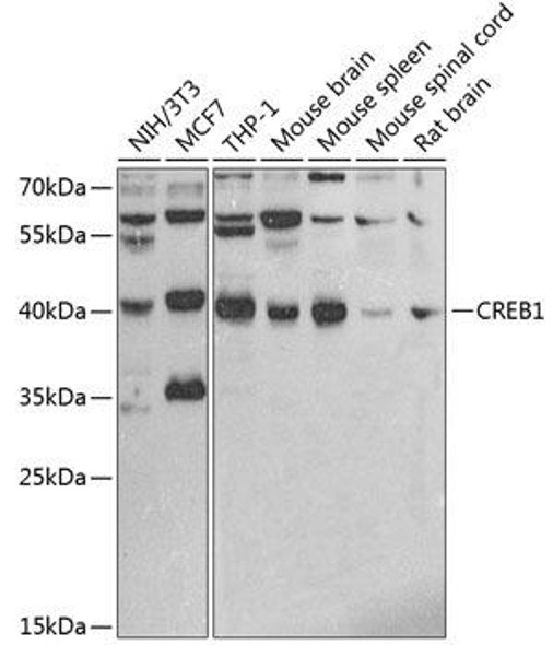 Anti-CREB1 Antibody (CAB2431)