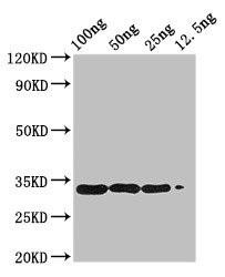BETVIA Antibody (PACO50286)