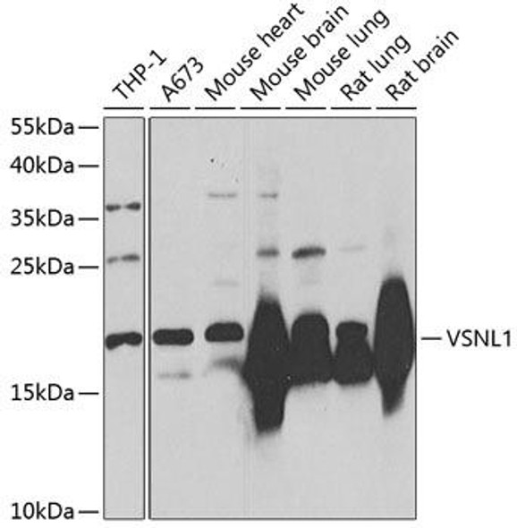 Anti-VSNL1 Antibody (CAB2797)