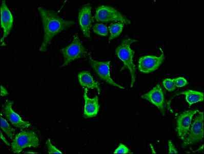 CABP2 Antibody (PACO51058)