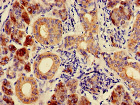 CA6 Antibody (PACO51370)