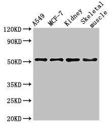 NARF Antibody (PACO51738)