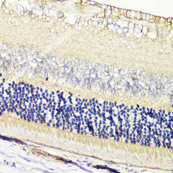 Anti-GRK1 Antibody (CAB2966)