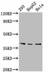 PTGR2 Antibody (PACO54954)