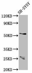 CDR2L Antibody (PACO57692)