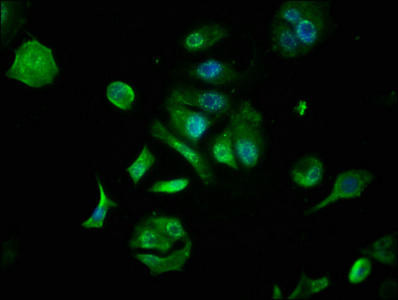 FOXO6 Antibody (PACO62283)