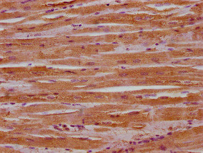 MACF1 Antibody (PACO62835)