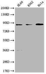 RPTN Antibody (PACO64499)
