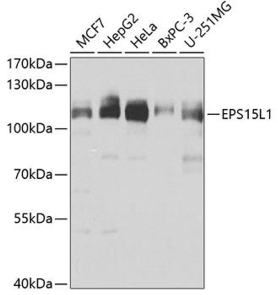 Anti-EPS15L1 Antibody (CAB7828)