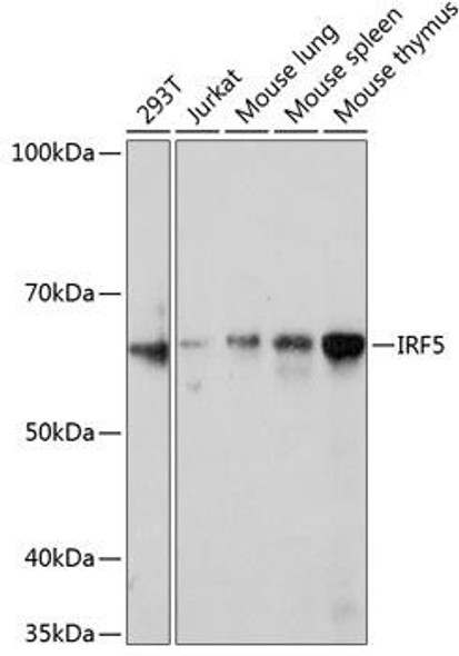 Anti-IRF5 Antibody (CAB11106)