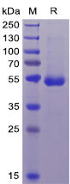 Human CD70 Recombinant Protein (mFc-His Tag) (HDPT0039)