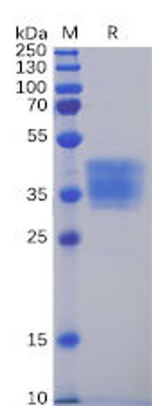 Human CLDN6 Recombinant Protein (mFc Tag) (HDPT0050)