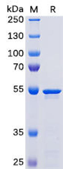 SARS-CoV-2 (2019-nCoV) Nucleocapsid, His Tag) (HDPT0073)
