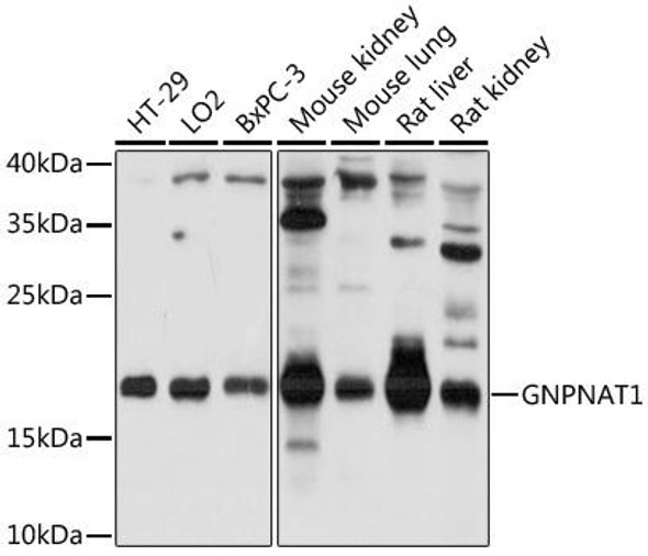 Anti-GNPNAT1 Antibody (CAB17759)