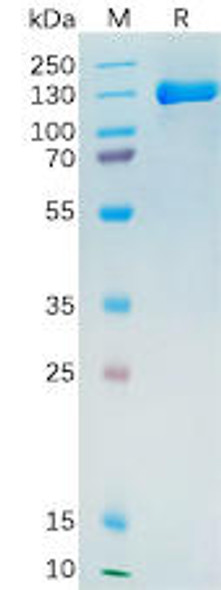 Human PSMA Recombinant Protein (hFc Tag) (HDPT0171)