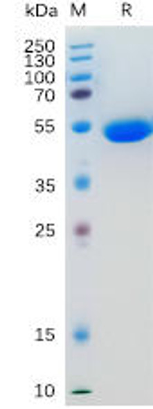 Human IL5 Recombinant Protein (hFc Tag) (HDPT0184)