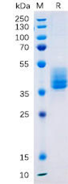 Human TM4SF1 Recombinant Protein (hFc Tag) (HDPT0185)