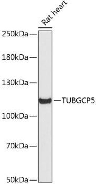 Anti-TUBGCP5 Antibody (CAB17815)