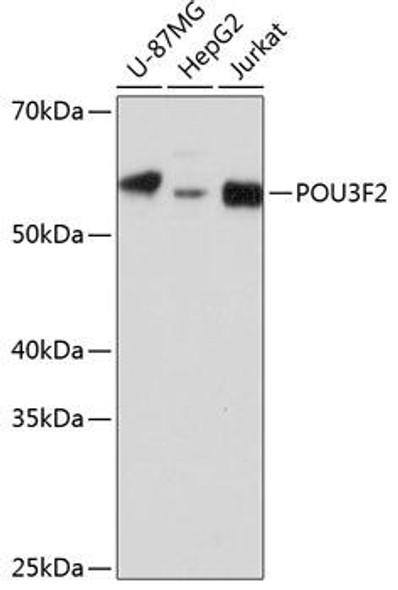 Anti-POU3F2 Antibody (CAB18576)