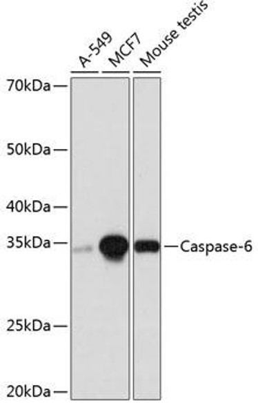 Anti-Caspase-6 Antibody (CAB19559)